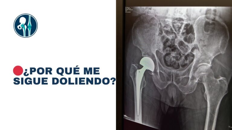 dolor de rodilla tras operación de cadera