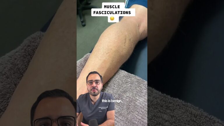 el agente mueve el brazo alternativamente de arriba abajo