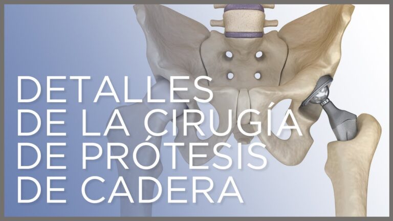 la operación de cadera es peligrosa