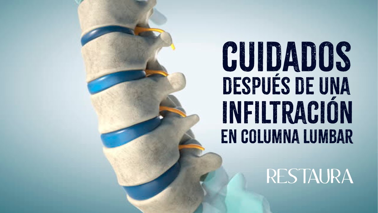 se puede conducir después de una infiltración